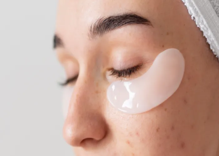 How to Find the Best Moisturizer for Acne-Prone Skin